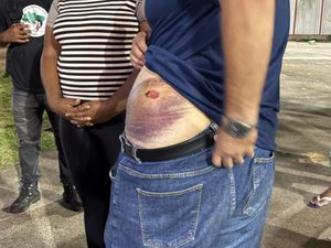 Candidato ao Governo da Bahia tem campanha prejudicada após ser alvejado com bala de borracha vencida